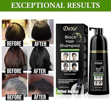 SHAMPOO ANTICANAS EN 5 MINUTOS